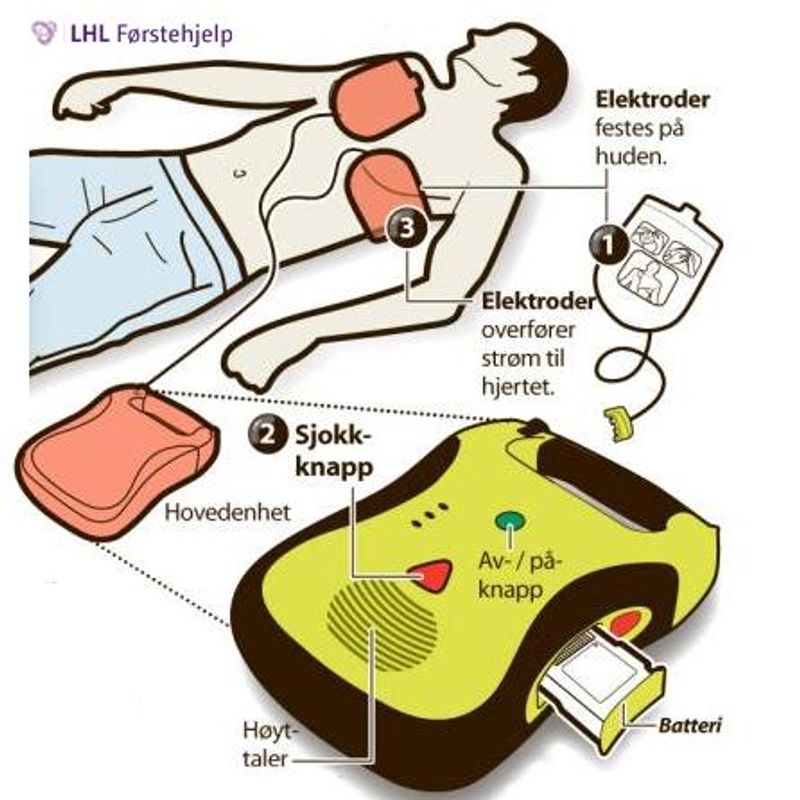 Lifeline AED Hjertestarterpakke, 7 års batteri